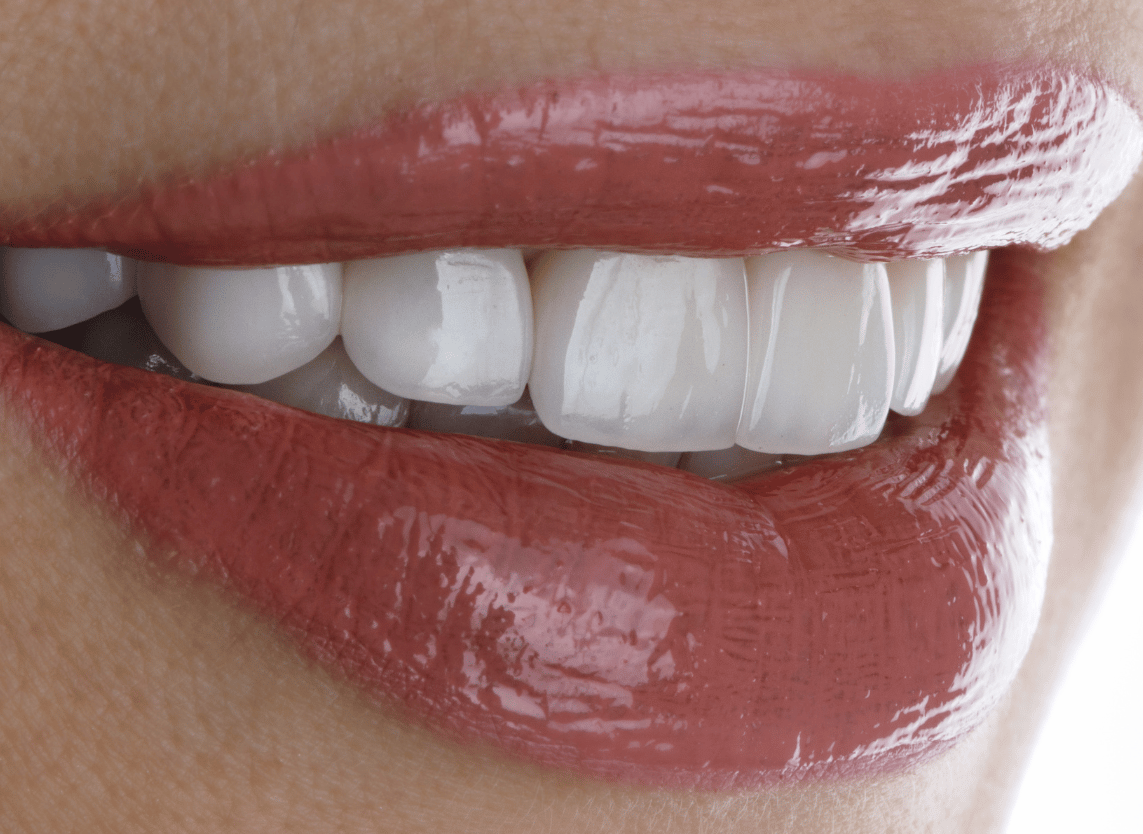 Procedure Image - The London Smile Clinic