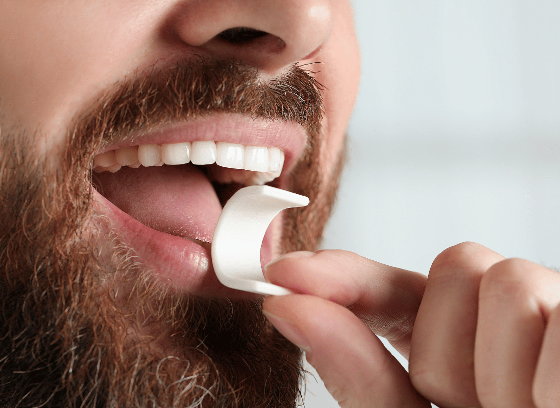 Procedure Image - The London Smile Clinic