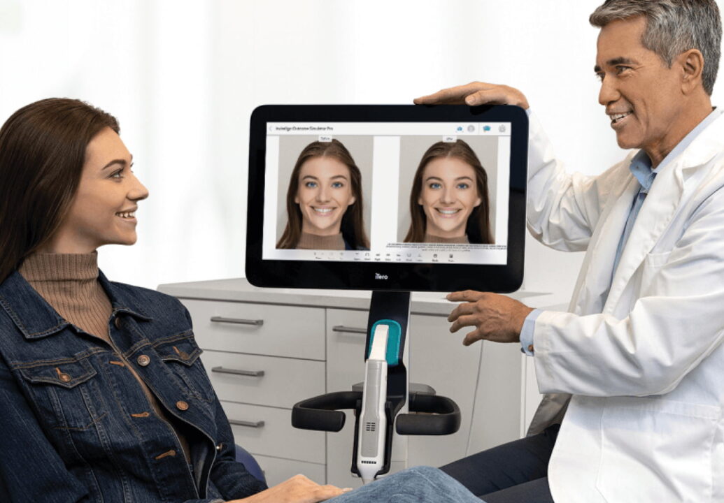  Invisalign Scan Image