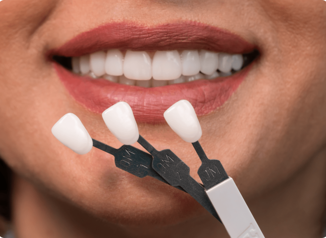 Procedure Image - The London Smile Clinic